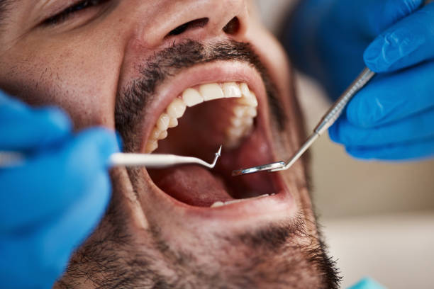 Emergency Dental Services in Havana, IL